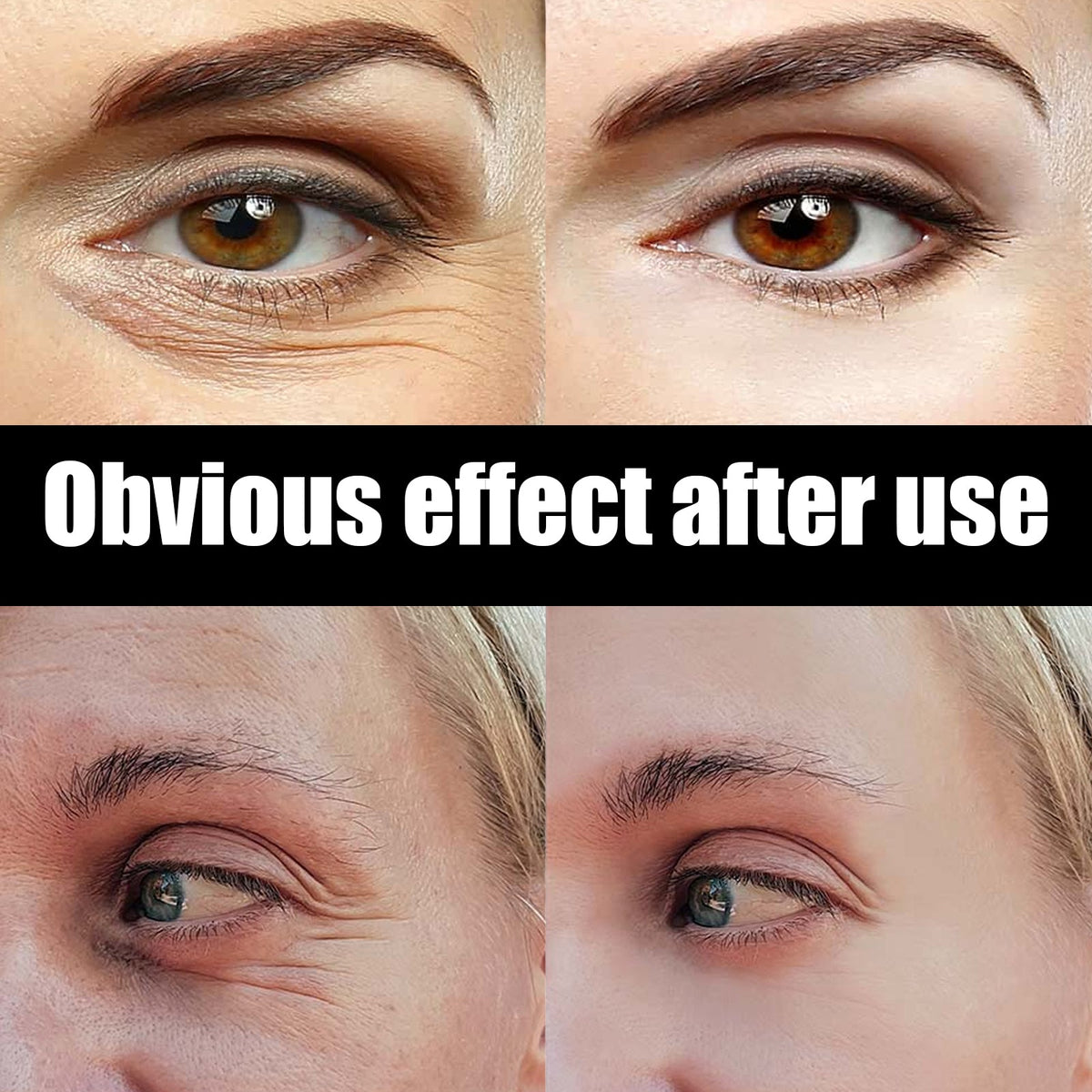 Astaxanthin Caviar Eye Cream, Moisturizing Skin Care Firming Fade Lines Eye Cream